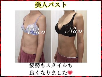 ニコ 岐南本店(Nico)/バスト★before→after