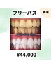 【人気No1★フリーパス】美白セルフホワイトニング40分×9回　¥44000