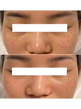 エルマナ(Hermana)/