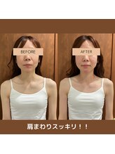 メグムサロン(Megumu Salon)/空ルート/肩こり腰痛/マッサージ