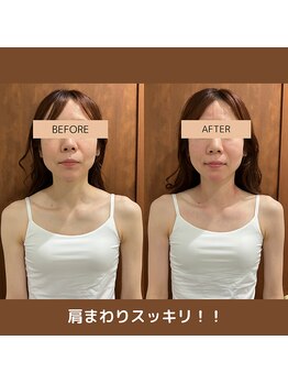 メグムサロン(Megumu Salon)/空ルート/肩こり腰痛/マッサージ