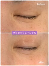 プリュネル(Prunelle)/プラズマシャワー