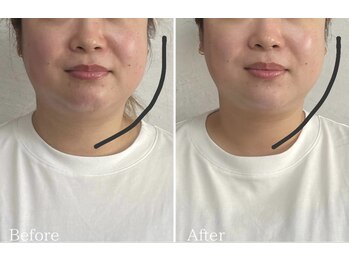 リタ(Rita.)/浮腫みが取れ、スッキリ小顔に