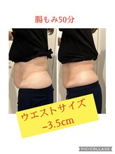 モイス(moisu)/腸もみでぽっこりお腹に激変！