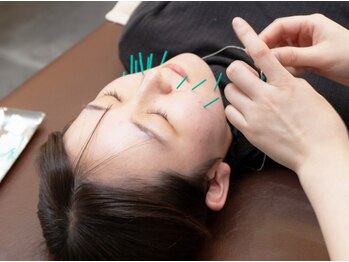 はぴねす鍼灸整骨院 大阪ドームシティ院の写真/【フェイシャル美容鍼】あなたのお悩みに合わせて…気になる箇所のツボを刺激し不調改善&血行促進！