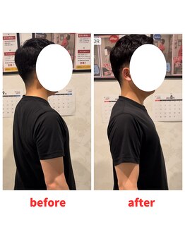 ナオル整体 福岡香椎院(NAORU整体)/40代男性施術事例【背中の痛み】