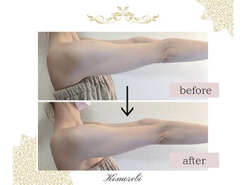 コモレビ(Komorebi)/