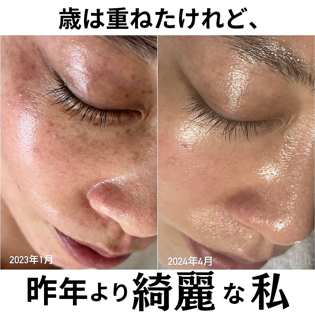 岩倉市で毛穴洗浄・毛穴吸引が人気のエステサロン｜ホットペッパー