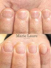 マリーロール 淀屋橋本店(Marie Laure)/自爪育成/深爪矯正/ネイルケア