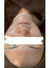 デイジー/綺麗なお肌もさらにキレイ/美白