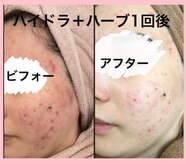 キッカ 梅田天六(Kikka)