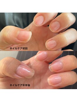 反り爪 ダメージ爪