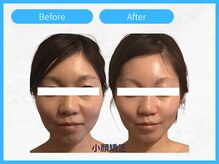 RHB東戸塚/小顔エステはRHB東戸塚