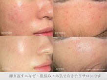 ヴェリス 新宿店(Velisse)
