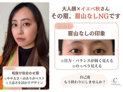シャルリス(CHALELISS)の写真