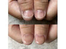 グラムネイル(gram nail)の雰囲気（「爪や指先にコンプレックスがある…」そんな方に）