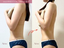 アイオン(Aion)/マシン×ハンドでお腹スッキリ♪