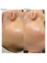 プリュスマイル(+Smile.)/フェイシャルワックス☆