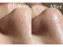 フフラバイプラス(FUFLA BY PLUS)/毛穴洗浄