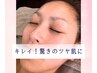 【ザラツキ解消！毛穴レス】つるつる肌に！正規店ララピール/ヘッド付￥25300