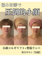 光癒(コウユ)/10回Before.After