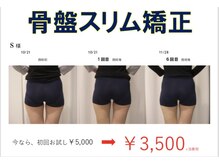 【整体】肩こり・腰痛・むくみ・代謝ダウン。根本から解消◎