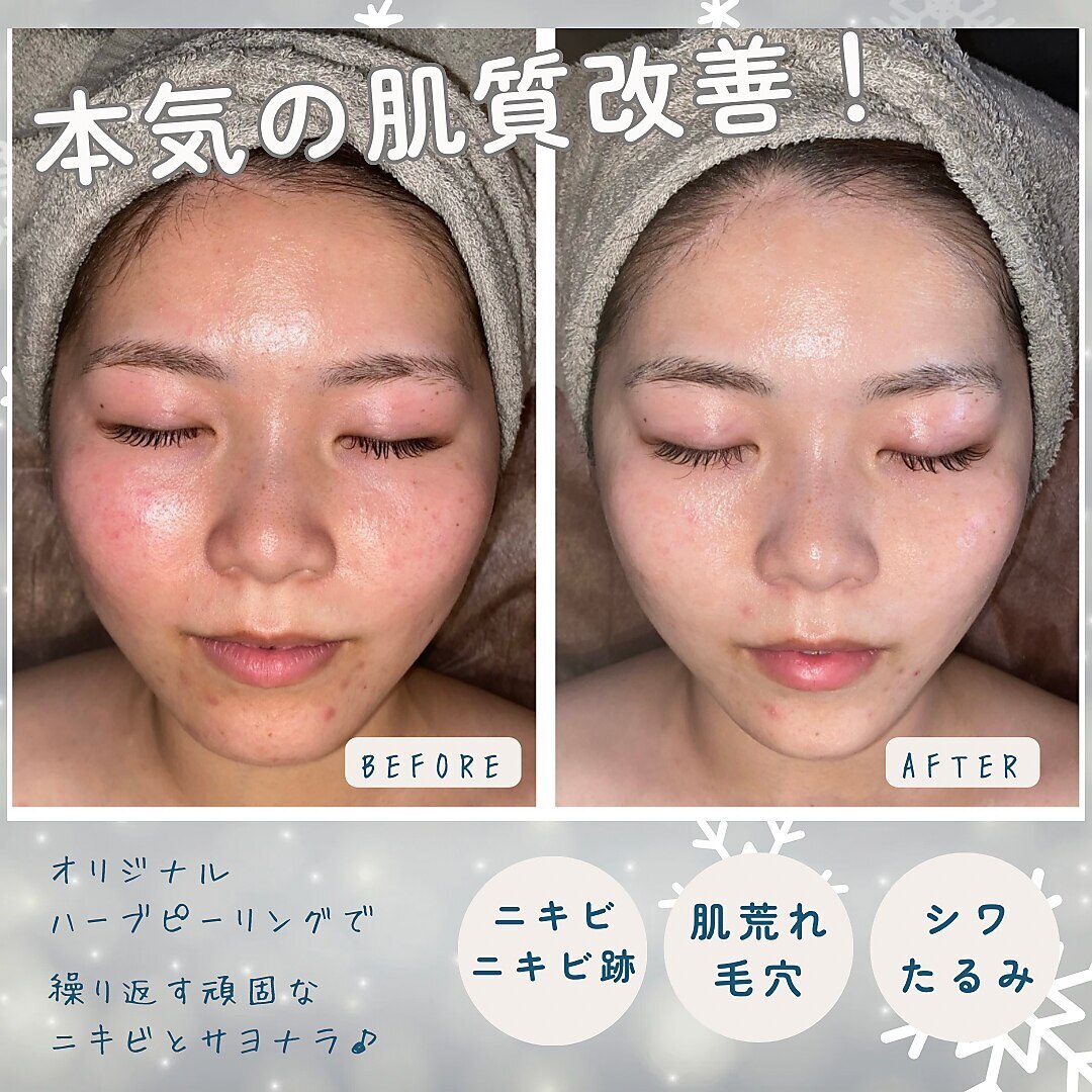 ブレアドール(Blair-Doll)｜ホットペッパービューティー