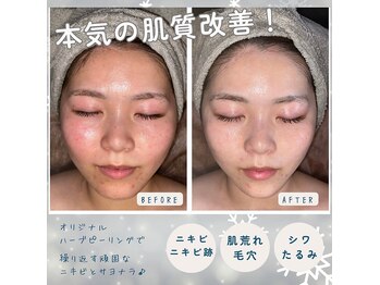 ブレアドール(Blair-Doll)