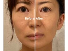 ドクターボディクリスタル(Dr.Body Crystal)