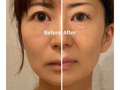 ドクターボディクリスタル(Dr.Body Crystal)の写真