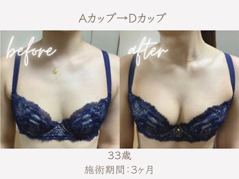 ハリスタ 西宮院(HARISTA)/3ヶ月間でBカップ→Dカップ