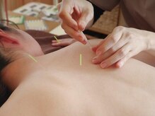 いしはら鍼灸整骨院