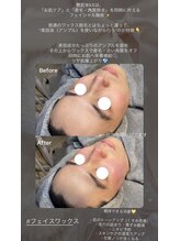 ラティーナ(Lattina)/毛穴洗浄×艶肌ワックス