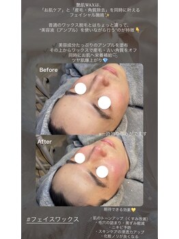 ラティーナ(Lattina)/毛穴洗浄×艶肌ワックス