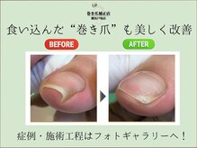 巻き爪補正店 横浜戸塚店の雰囲気（巻き爪・肥厚爪・タコ魚の目・副爪の症例はフォトギャラリーへ！）