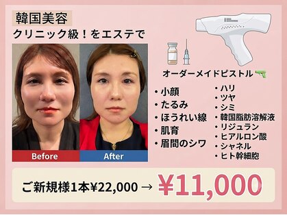 ルアナ(Luana)の写真