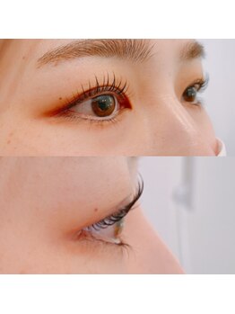 アディクト 恵比寿店(ADDICT)/横から見ても自然な丸み