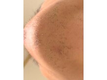 エム(M)