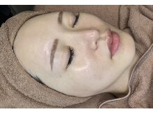 ルルアス(LuLu AS)/ララピールで艶肌