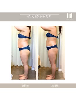 カリスボーテ 関本店/3ヶ月集中コース