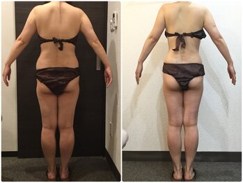 美容整体ウェリナ 名駅院/小顔矯正/骨盤矯正/美脚サロン