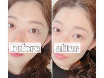 アイル(I’LL)/ブロウリフト