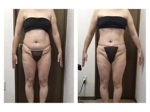 Hb 与野/電磁パルス（腹筋形成マシン）