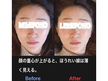 美容矯正サロン レレポノ(LELEPONO)/
