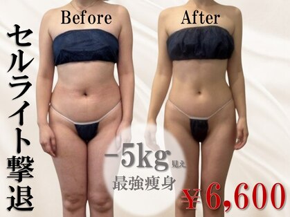 リモアボーテ(RIMOA beaute)の写真