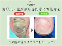 巻き爪補正店 横浜戸塚店の雰囲気（初めての方もお気軽にご来店ください。）