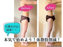 ヨサパーク バトン 西宮店(YOSAPARK Baton)の雰囲気(ぽっこりお腹、下半身痩せ、二の腕、お任せください♪)