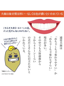 ライトビューティー 本八幡店(LIGHT BEAUTY)/歯ピネス!歯ピ男!