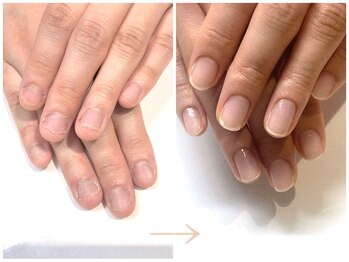 インブロッサム(imblossom)/自信の持てる手へ