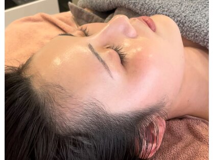 ロッシュ フェイス(Roche Face)の写真